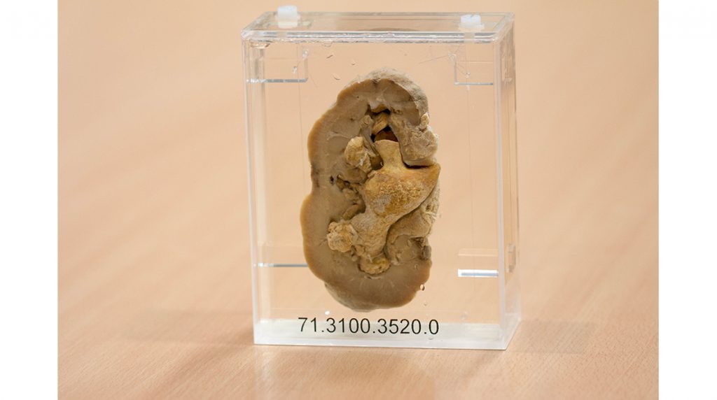 Top treasures at Imperial College London's Pathology Museum