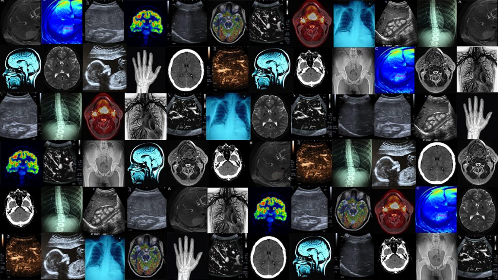 How machine learning will transform the way we look at medical images