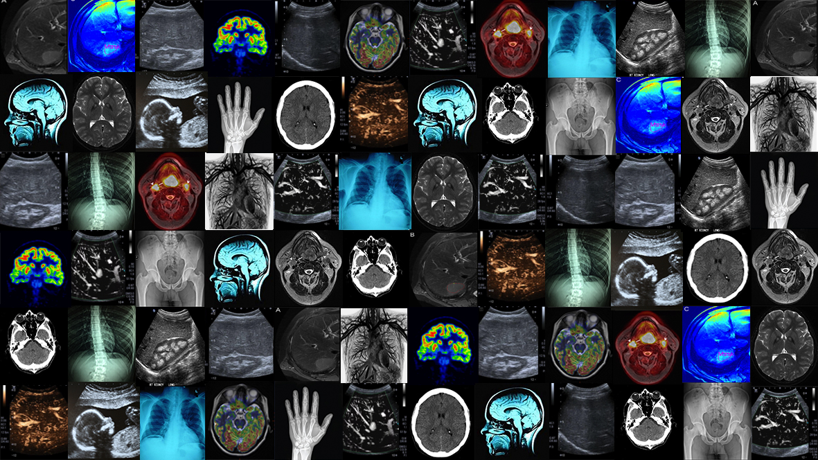 How machine learning will transform the way we look at medical images