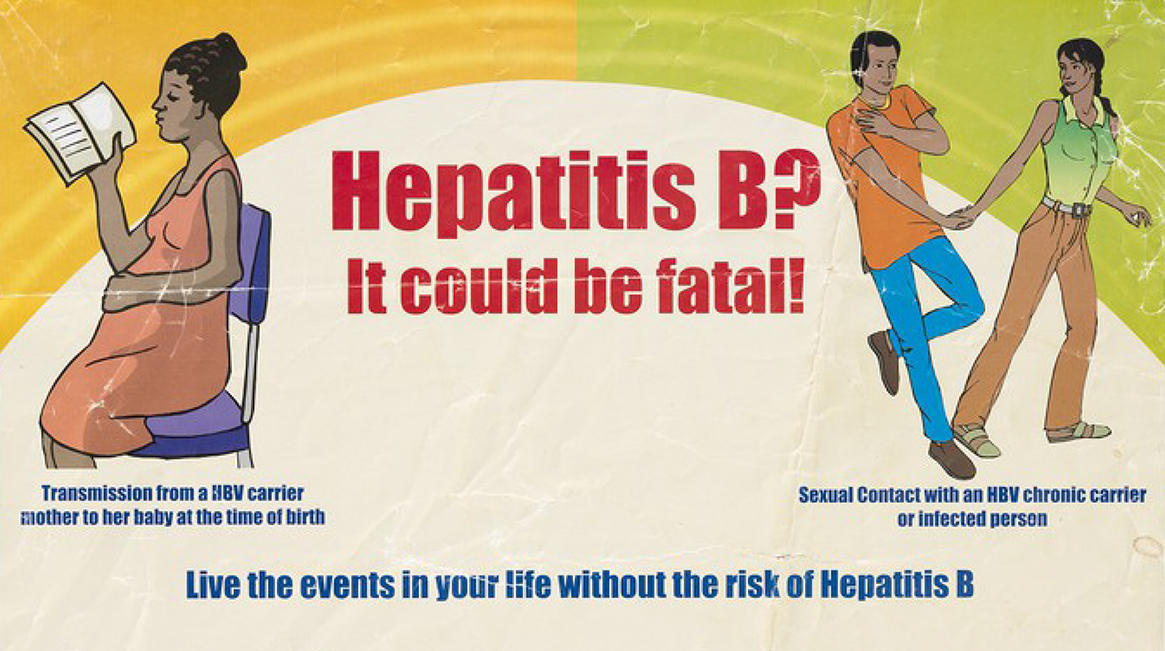 Hepatitis B