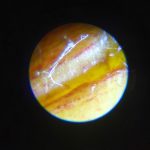 An image of an apple leaf through the mini-mircoscope